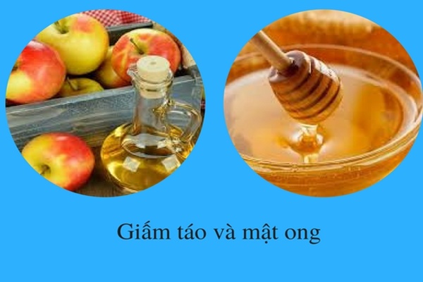 Cách trị mụn bằng giấm táo và mật ong.