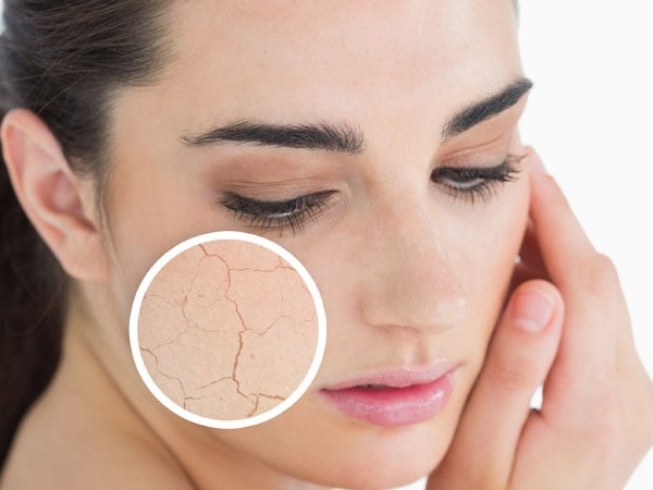 Rửa mặt không sạch sẽ gây ra các vấn đề về da.