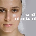 Lỗ chân lông là gì? Nguyên nhân và cách điều trị lỗ chân lông to?